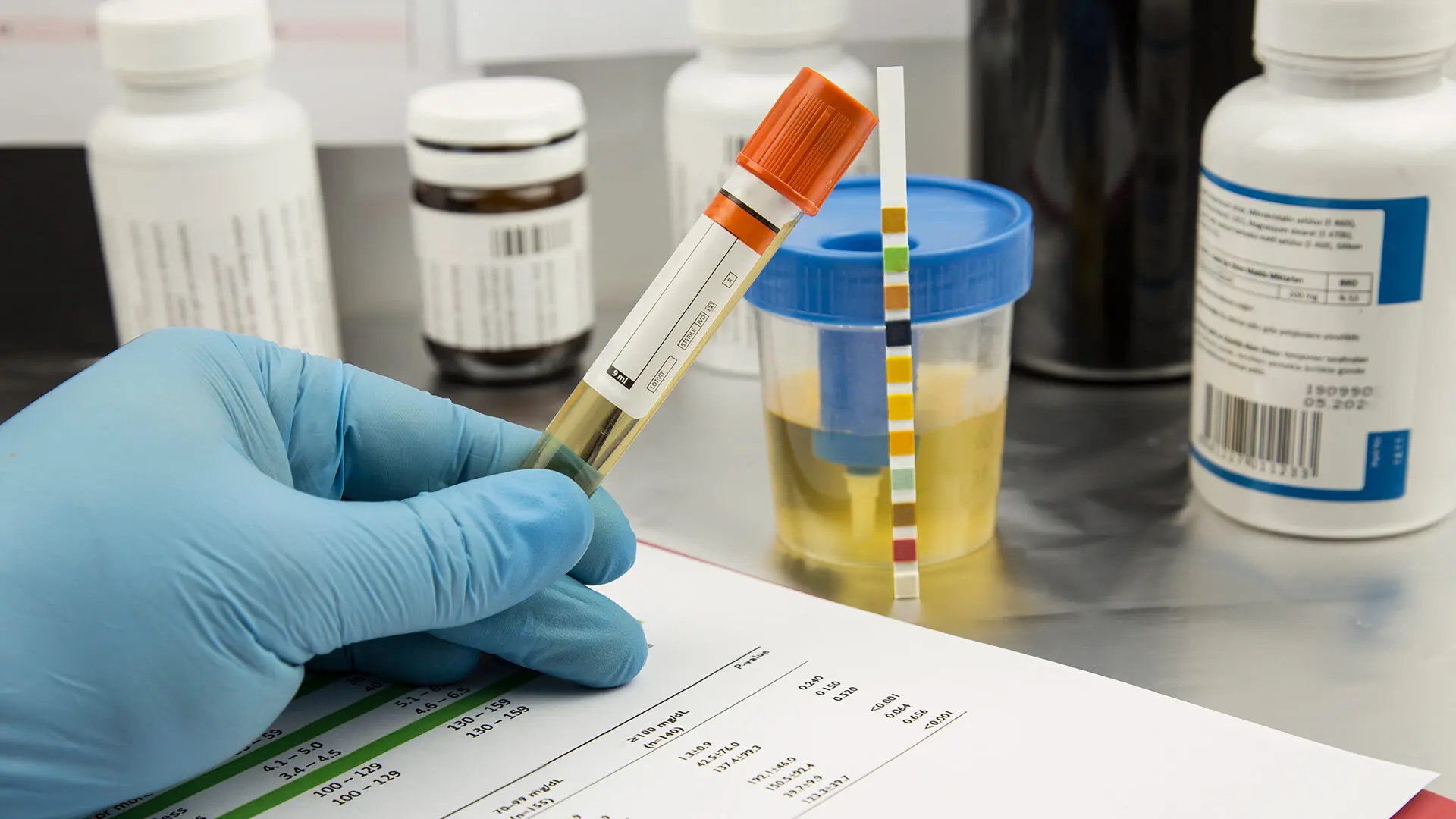 Urine Drug Testing
